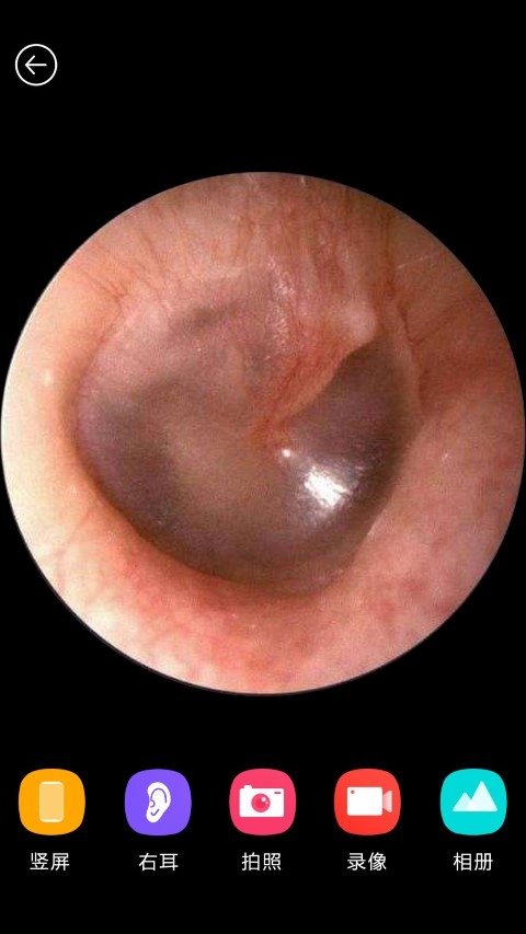 蜂鸟采耳app官方下载